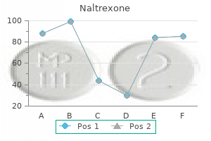purchase naltrexone 50 mg overnight delivery