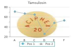 cheap tamsulosin 0.4mg otc