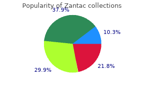 150 mg zantac amex